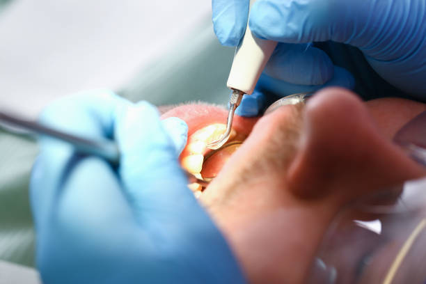 Best Emergency Broken Tooth Repair in Jamestown, CA