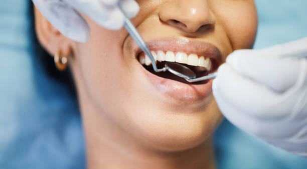 Best Emergency Treatment for Toothache in Jamestown, CA